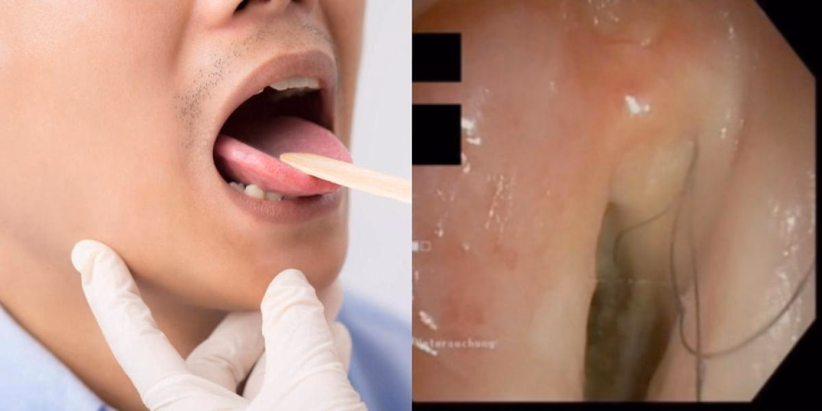 ¿Por qué siento como cabello en la garganta?