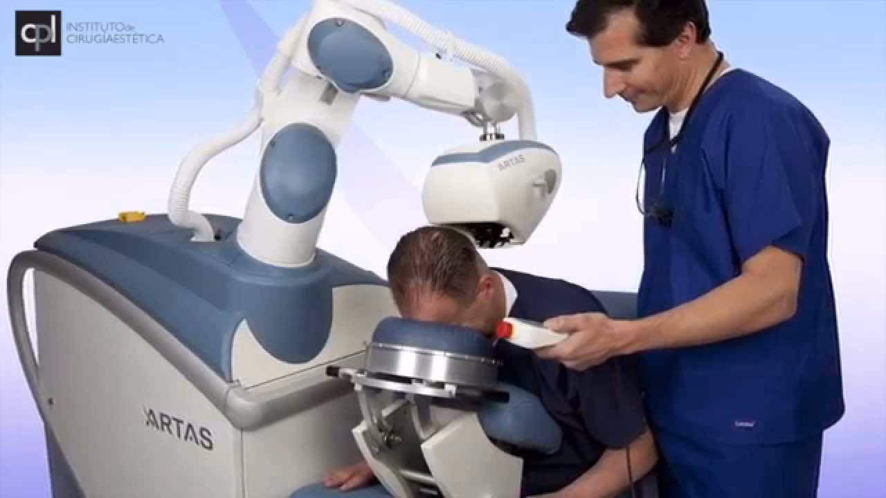 ¿Es bueno el trasplante de cabello Artas?
