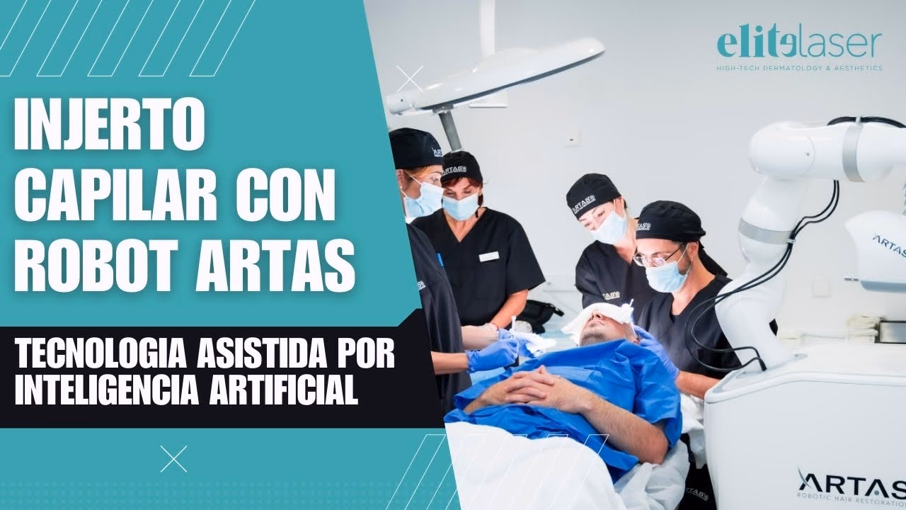 ¿Cuál es la diferencia entre FUE y Artas?