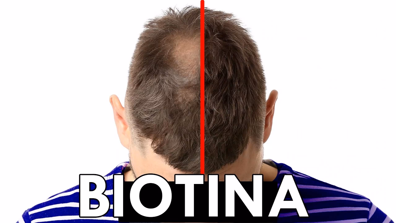 ¿Qué pasa si me aplico biotina en el cabello?