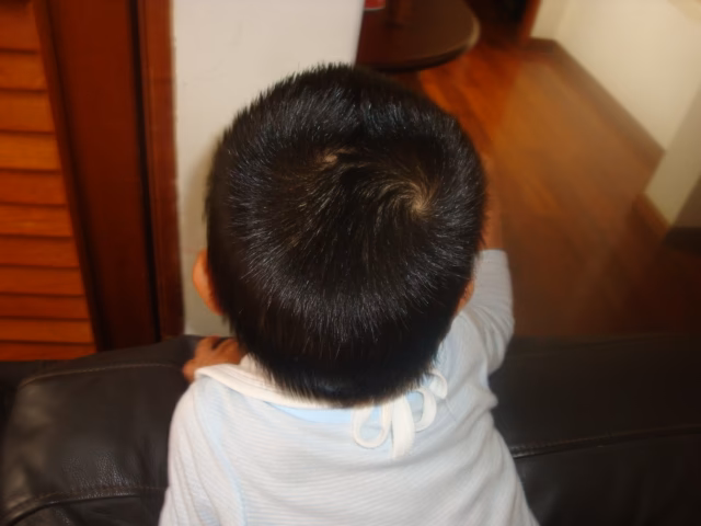 ¿Por qué tengo tres remolinos en la cabeza?