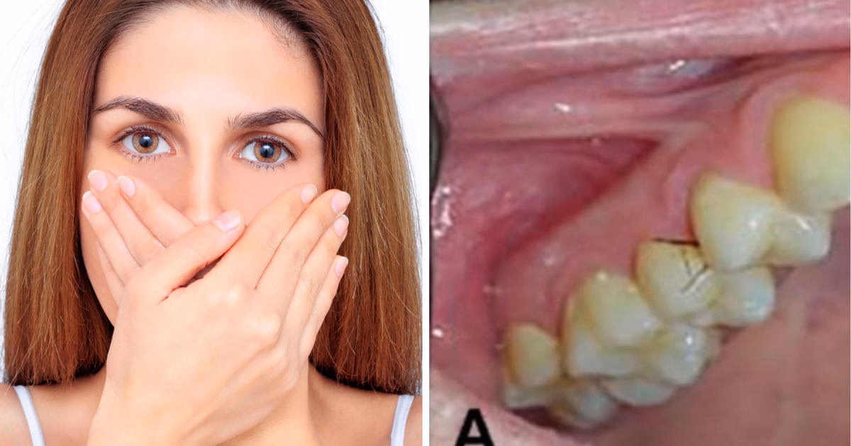 ¿Por qué la gente se lleva el pelo a la boca?